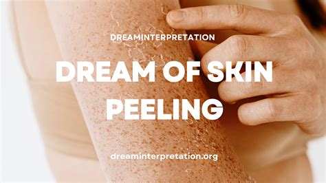 The Spiritual Significance of Peeling Dead Skin in a Dream
