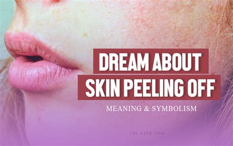 The Spiritual Significance of Peeling Dead Skin in a Dream